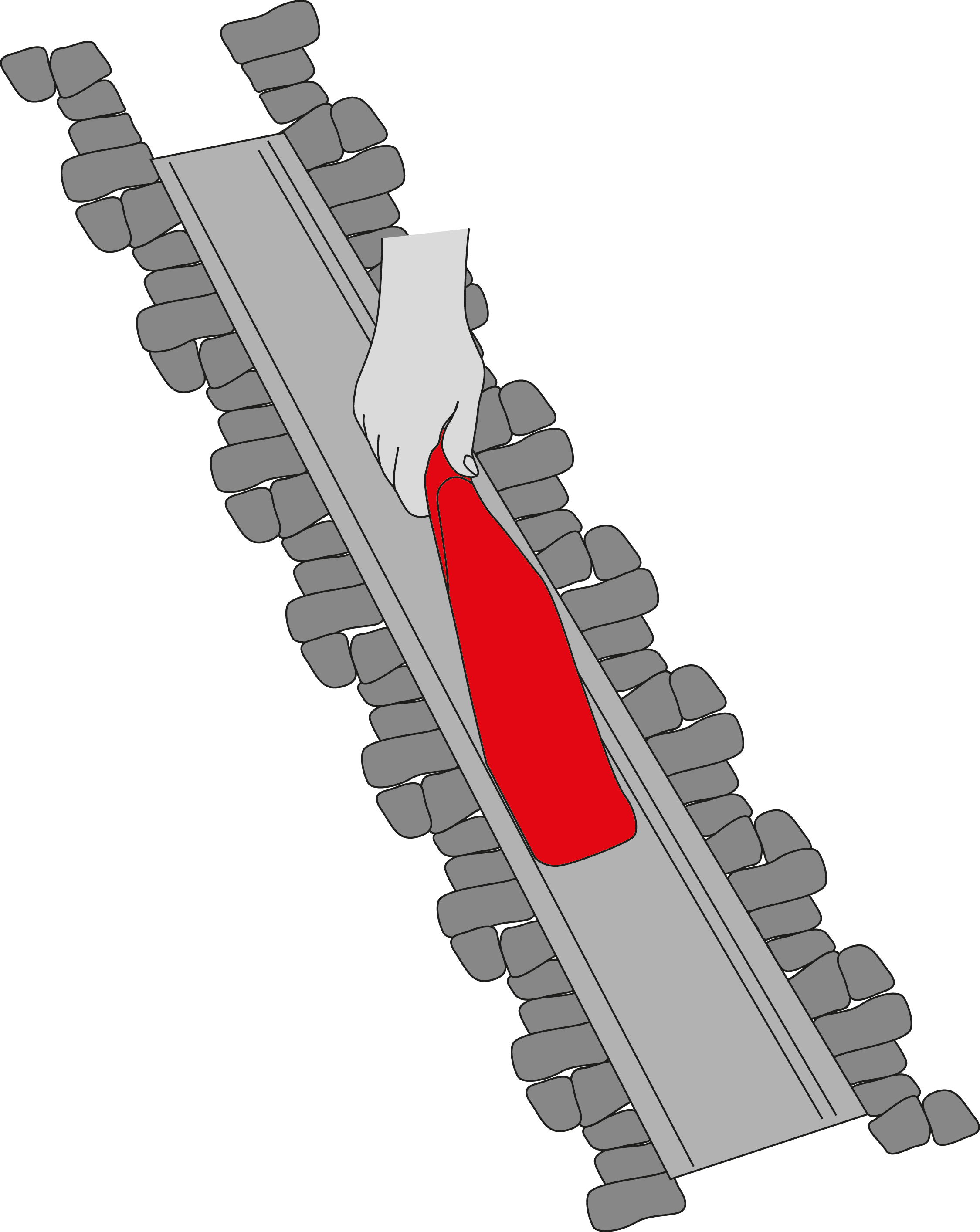 Zeichn_RSK